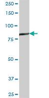 Anti-GSN Mouse Polyclonal Antibody