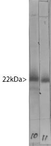 Western blot of bovine cerebellum homogenate stained with Anti-Visinin Like Protein 1 Antibody in Lane 11. Note the strong clean band running at 22 kDa. Lane 10 shows the same material stained with Anti-Visinin Like Protein 1 Antibody (A85345) which binds to the same band