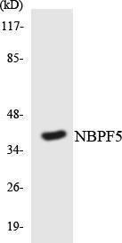 Western blot analysis of the lysates from K562 cells using Anti-NBPF5 Antibody