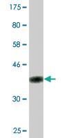 Anti-TNFSF11 Mouse Monoclonal Antibody [clone: 3F7]