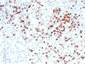 Immunohistochemical analysis of formalin-fixed, paraffin-embedded human spleen tissue using Anti-Myeloperoxidase Antibody [MPO/7116]. Inset: PBS instead of the primary antibody. Secondary antibody negative control