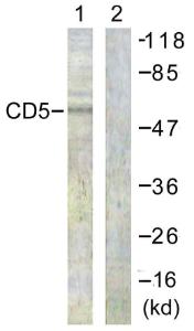 Antibody anti-CD5 100 µg