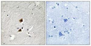 Immunohistochemical analysis of paraffin-embedded human brain using Anti-HNRPLL Antibody 1:100 (4 °C overnight). The right hand panel represents a negative control, where the Antibody was pre-incubated with the immunising peptide