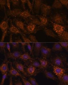 Immunofluorescence analysis of C6 cells using Anti-HIBADH Antibody (A305430) at a dilution of 1:100. DAPI was used to stain the cell nuclei (blue).