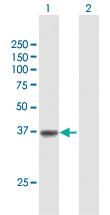 Anti-SLC22A18 Mouse Polyclonal Antibody