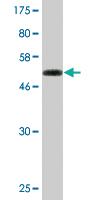 Anti-LCMT1 Mouse Monoclonal Antibody [clone: 3D3]