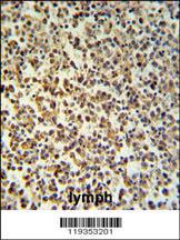 Anti-GZMB Rabbit Polyclonal Antibody