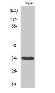 Anti-DHRS4 antibody