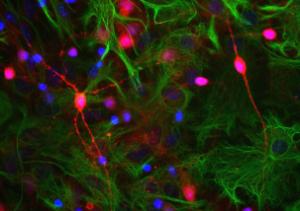 Neuron-glia cell culture stained with Anti-Visinin Like Protein 1 Antibody (red), Anti-GFAP Antibody (A85422/green) and DNA (blue)