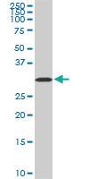 Anti-AQP8 Mouse Monoclonal Antibody [clone: 1A1]