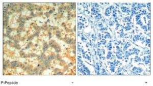 Anti-SYK Rabbit Polyclonal Antibody