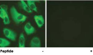 Anti-KCNJ16 Rabbit Polyclonal Antibody