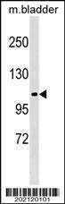 Anti-FGA Mouse Monoclonal Antibody [clone: 471CT12.1.2]