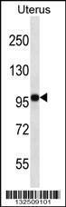 Anti-FGD4 Rabbit Polyclonal Antibody (FITC (Fluorescein Isothiocyanate))