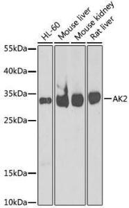 Western blot analysis of extracts of various cell lines, using Anti-AK2 Antibody (A9900) at 1:1,000 dilution