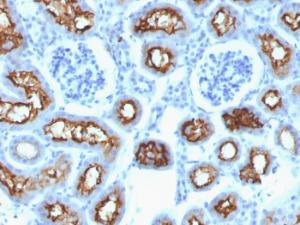 Immunohistochemical analysis of formalin-fixed, paraffin-embedded mouse kidney using Anti-CFTR Antibody [CFTR/1342]