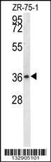 Anti-NIT1 Rabbit Polyclonal Antibody (APC (Allophycocyanin))