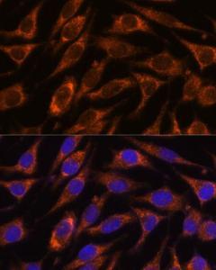 Immunofluorescence analysis of L929 cells using Anti-HIBADH Antibody (A305430) at a dilution of 1:100. DAPI was used to stain the cell nuclei (blue).