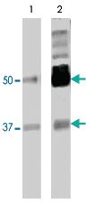 Anti-PTBP2 Mouse Monoclonal Antibody [clone: 2D10-B2]