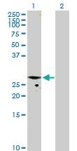 Anti-CMPK1 Mouse Polyclonal Antibody