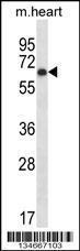 Anti-PKMYT1 Rabbit Polyclonal Antibody (HRP (Horseradish Peroxidase))