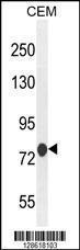 Anti-MCAF2 Rabbit Polyclonal Antibody (Biotin)