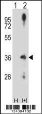 Anti-CCND2 Rabbit Polyclonal Antibody (AP (Alkaline Phosphatase))