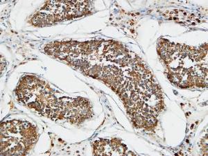 Immunohistochemical analysis of paraffin-embedded human testis using Anti-TACC3 Antibody