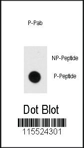 Anti-MBP Rabbit Polyclonal Antibody