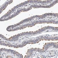 Anti-LACE1 Rabbit Polyclonal Antibody