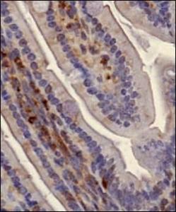 Anti-Podocalyxin Rabbit Polyclonal Antibody