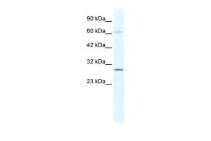 Anti-PARP11 Rabbit Polyclonal Antibody