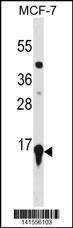 Anti-HIST2H3A Rabbit Polyclonal Antibody (AP (Alkaline Phosphatase))