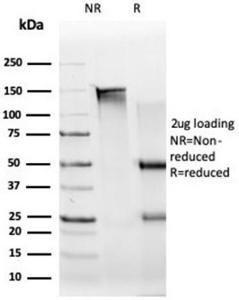 SDS-PAGE analysis of Anti-UBR2 Antibody [PCRP-UBR2-1D12] under non-reduced and reduced conditions; showing intact IgG and intact heavy and light chains, respectively. SDS-PAGE analysis confirms the integrity and purity of the antibody.