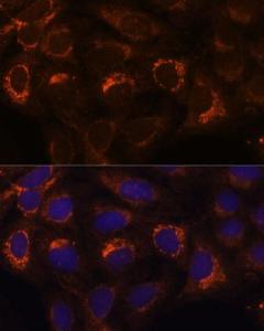 Immunofluorescence analysis of U-2 OS cells using Anti-HIBADH Antibody (A305430) at a dilution of 1:100. DAPI was used to stain the cell nuclei (blue).