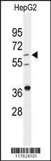 Anti-DHCR24 Rabbit polyclonal antibody