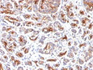 Immunohistochemical analysis of formalin-fixed, paraffin-embedded human pancreas using Anti-CFTR Antibody [SPM176]