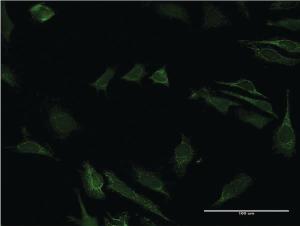 Anti-CD40 Mouse Monoclonal Antibody [clone: 4F11]