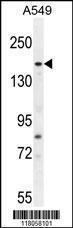 Anti-FGD6 Rabbit Polyclonal Antibody (Biotin)