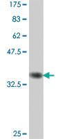 Anti-GLTSCR2 Mouse Polyclonal Antibody