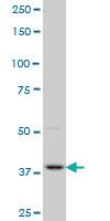 Anti-PBK Mouse Monoclonal Antibody [clone: 4A10]