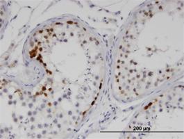 Anti-SSX2 Mouse Monoclonal Antibody [clone: 1A4]