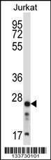 Anti-ARHGDIB Rabbit Polyclonal Antibody (FITC (Fluorescein Isothiocyanate))