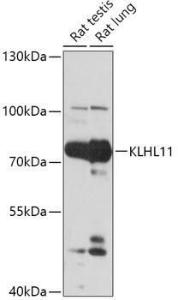 Western blot analysis of extracts of various cell lines, using Anti-KLHL11 Antibody (A305431) at 1:1,000 dilution