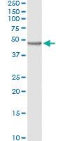 Anti-CD209 Mouse Monoclonal Antibody [clone: 3B10]