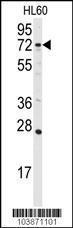 Anti-DGKA Rabbit Polyclonal Antibody (FITC (Fluorescein))