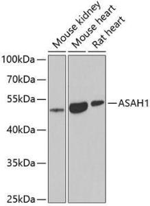 Western blot analysis of extracts of various cell lines, using Anti-ASAH1 Antibody (A9903) at 1:1000 dilution