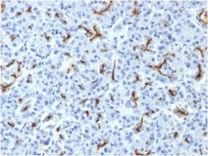 Immunohistochemical analysis of formalin-fixed, paraffin-embedded human pancreas using Anti-CFTR Antibody [CFTR/1643]