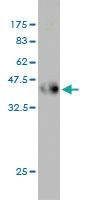 Anti-CKS2 Mouse Monoclonal Antibody [clone: 2H5-2C4]