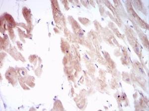 Anti-Myosin, Cardiac, Heavy Chain Mouse Monoclonal Antibody [clone: 8L880]